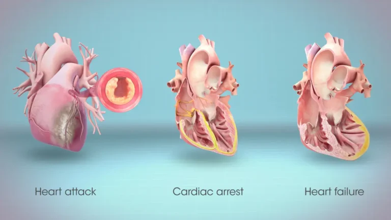 Cardiac Arrest, Heart Attack & Heart Failure: 7 Must-Know Facts